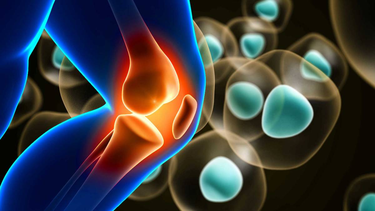 Medicina Regenerativa Articular